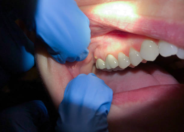 Best Emergency Orthodontic Repairs in Nicoma Park, OK