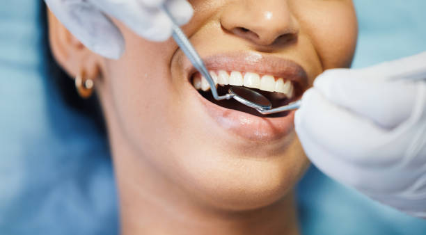 Best Emergency Tooth Extraction in Nicoma Park, OK