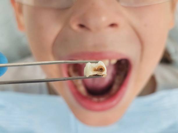 Best Same-Day Emergency Dentist in Nicoma Park, OK
