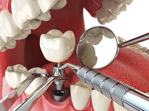 Best Emergency Tooth Extraction in Nicoma Park, OK